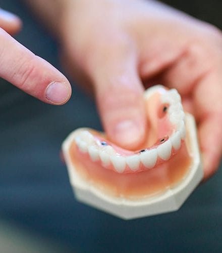 doctor holding prosthetic teeth and gums, pointing at the top